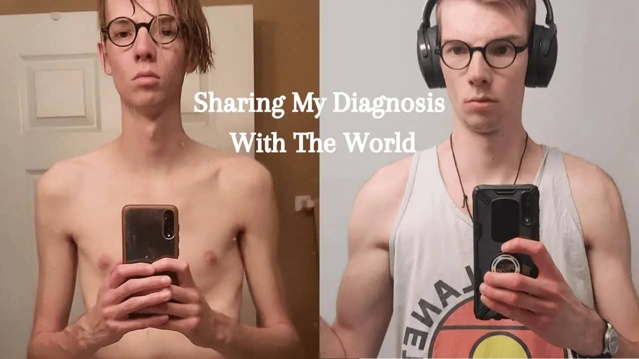 Sharing My Diagnosis With The World