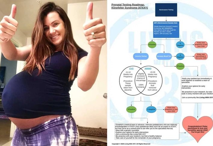 Klinefelter Prenatal Testing Guide