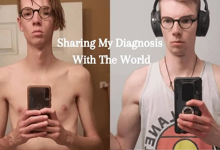 Sharing My Diagnosis With The World