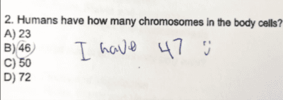 Teenage Klinefelter diagnosis