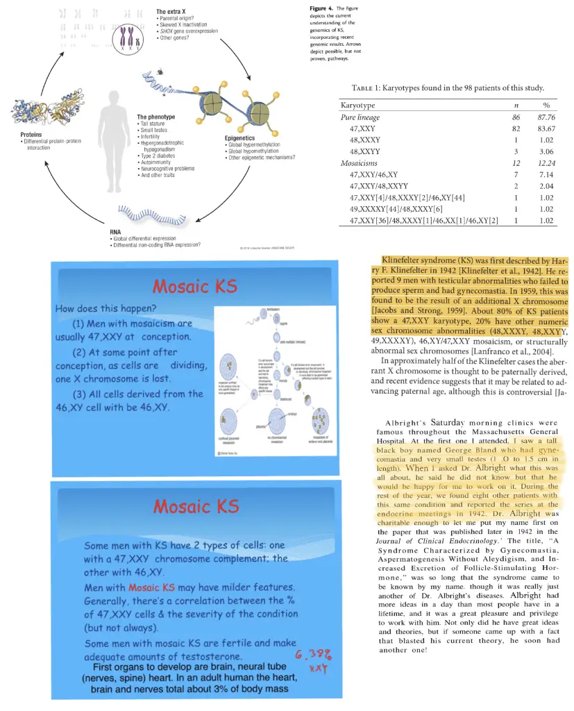 Mosaic Klinefelter Syndrome